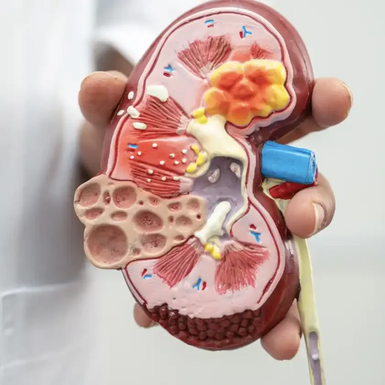 Overactive-bladder-treatment-bursa