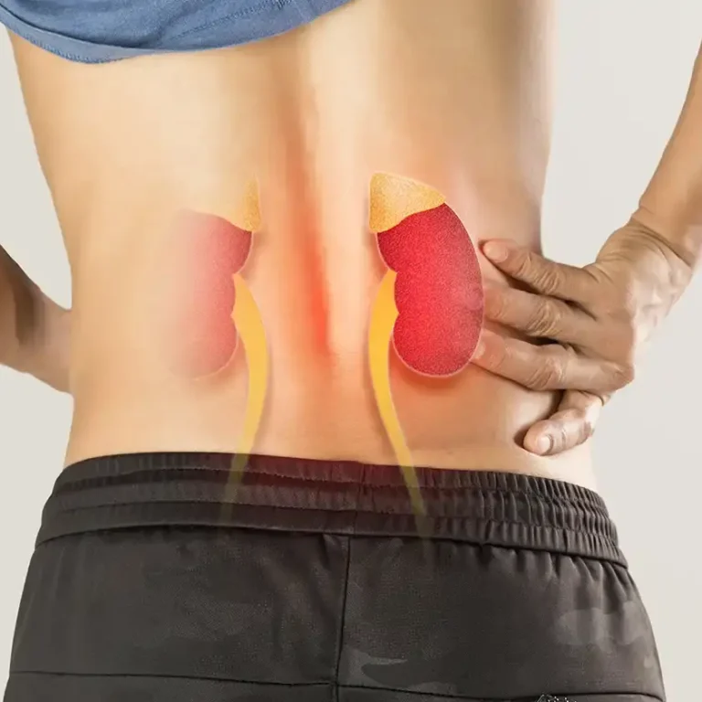 Most-effective-methods-for-kidney-stones