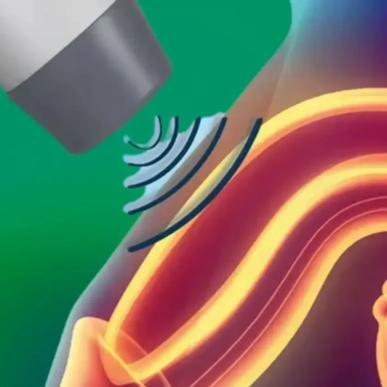 eswt-application-is-painful-mi